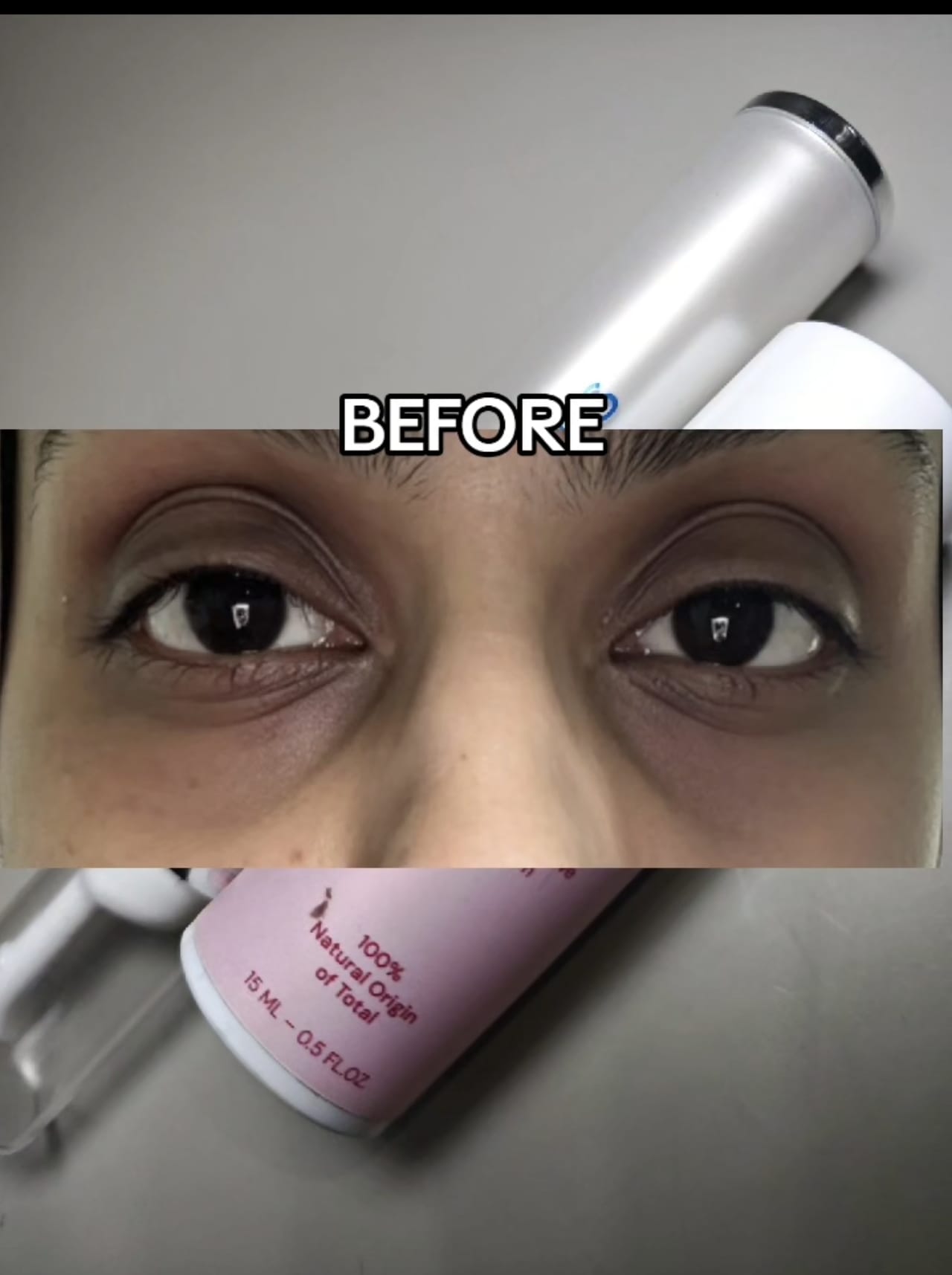 Applying Skinetics 2 Minute Dark Circle Eye Repair under the eyes